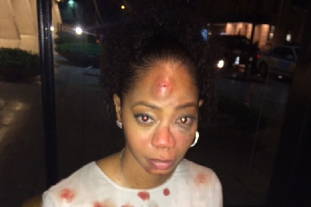 Spider Man 3 Actress Sues Nyc Restaurant Over Alleged Assault